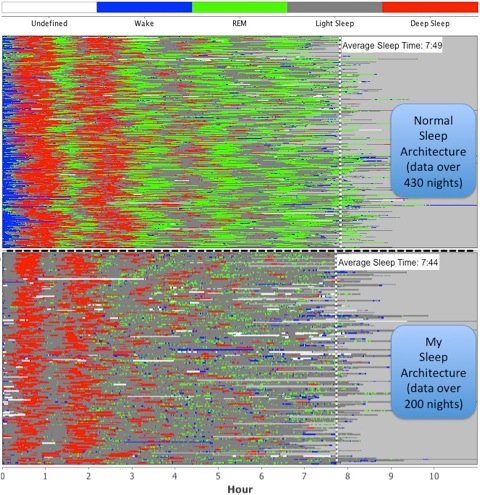 sleep_cycles_comparison